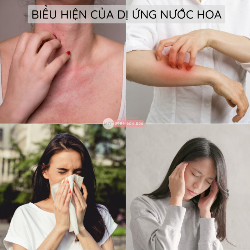 Dị ứng nước hoa Nguyên nhân và cách khắc phục (3)