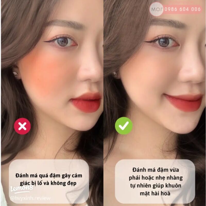 cách chữa Đôi Má Quá Đậm Vì Má Hồng Sữa MOI Baby Cheek, 4 Cách Chữa Cháy Thần Tốc